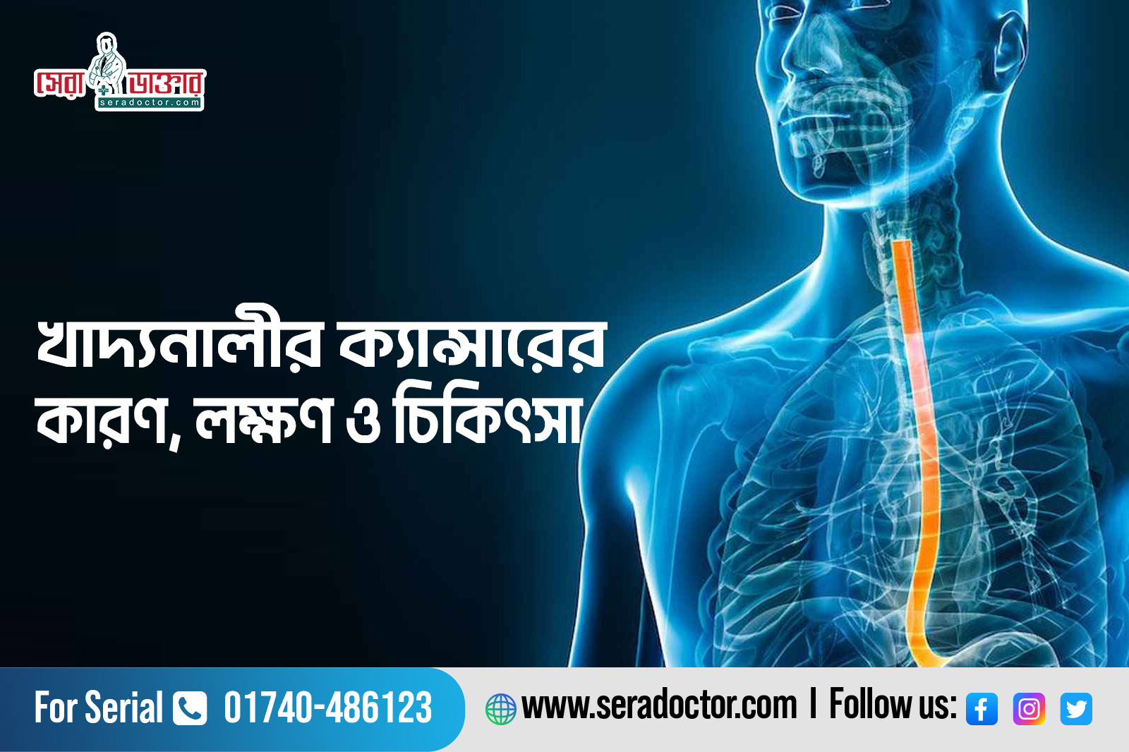 খাদ্যনালীর ক্যান্সারের কারণ, লক্ষণ ও চিকিৎসা 